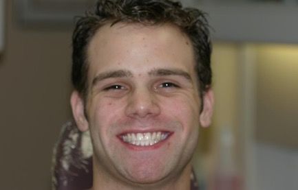 After cosmetic dentistry